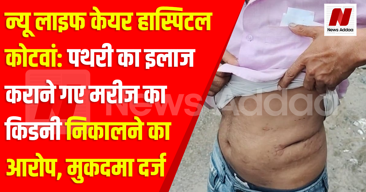 न्यू लाइफ केयर हास्पिटल कोटवां:: पथरी का इलाज कराने गए मरीज का किडनी निकालने का आरोप, मुकदमा दर्ज