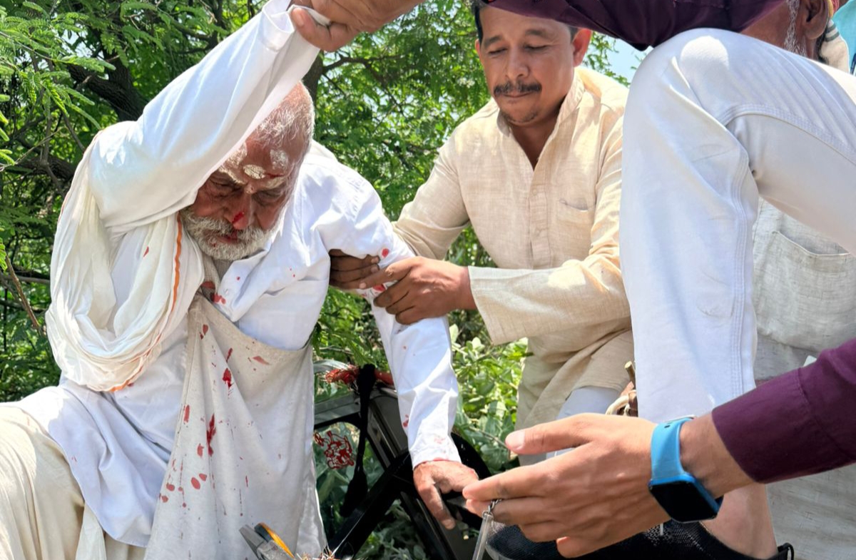 तेज ठोकर से बाइक सवार घायल, एक युवक की मौत